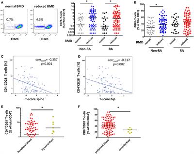 Senescent T-Cells Promote Bone Loss in Rheumatoid Arthritis